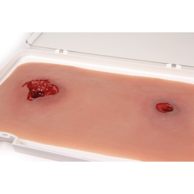 Erler Zimmer Wound Moulage Leg Bullet Wound | Health and Care